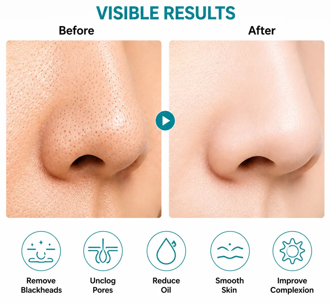 5 in 1 Blackhead Remover & Acne Pore Cleaner
